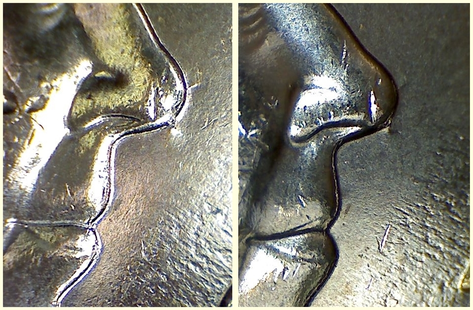 Anzac-2014-Chin-Wart!